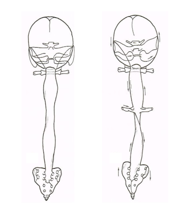 頭蓋仙骨系とゆがみの関係を表す絵